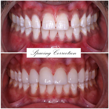 Slider image (7) FMS Dental Hospital - Kukatpally